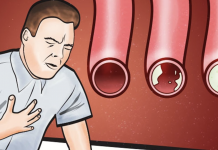 Eat these foods to clean your arteries and protect your heart