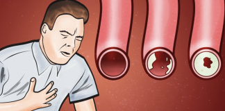 Eat these foods to clean your arteries and protect your heart