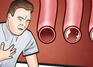 Eat these foods to clean your arteries and protect your heart