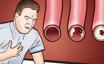 Eat these foods to clean your arteries and protect your heart