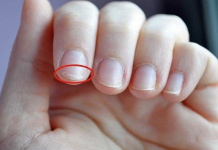 If you have troubles sleeping or brittle nails, use these 10 home remedies