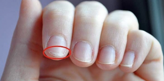 If you have troubles sleeping or brittle nails, use these 10 home remedies