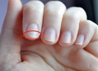 If you have troubles sleeping or brittle nails, use these 10 home remedies