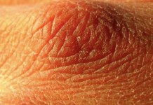 If you notice these 10 signs then you are not drinking enough water