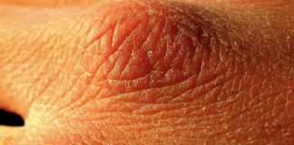 If you notice these 10 signs then you are not drinking enough water