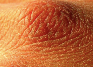 If you notice these 10 signs then you are not drinking enough water