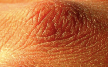 If you notice these 10 signs then you are not drinking enough water