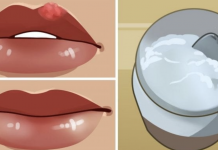 Make these 2 DIY lip balms to heal cold sores