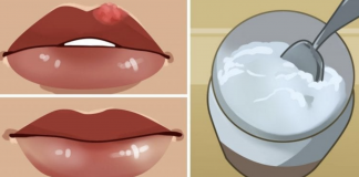 Make these 2 DIY lip balms to heal cold sores