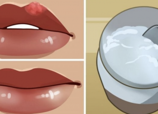 Make these 2 DIY lip balms to heal cold sores