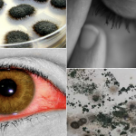 12 Signs You May Have a Mold Illness