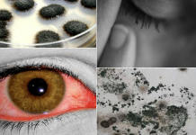 12 Signs You May Have a Mold Illness