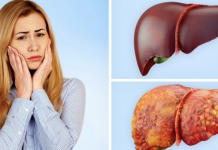 If you have these 9 signs then you need a detoxification