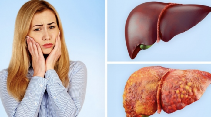 If you have these 9 signs then you need a detoxification