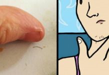 The Meaning Behind Chin Whiskers For Women