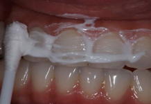 This recipe can help you whiten your teeth and terminate tartar and gingivitis