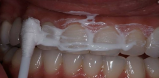 This recipe can help you whiten your teeth and terminate tartar and gingivitis