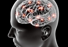 Make sure to do these 10 things to prevent Alzheimer’s disease