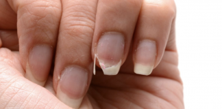 Signs and Symptoms of Calcium Deficiency