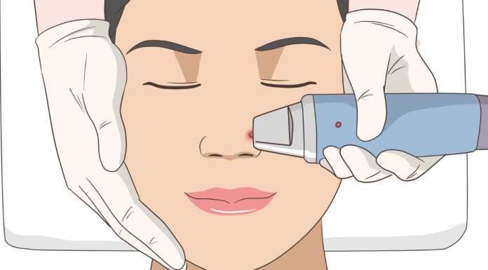 6 Ways To Get to Shrink Of Pimples Overnight