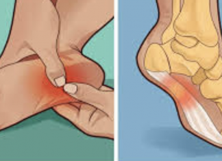 These home remedies can help you deal with water retention