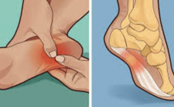 These home remedies can help you deal with water retention