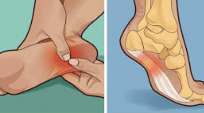 These home remedies can help you deal with water retention