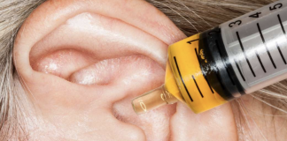 5 Ways How to Treat Itchy Ears