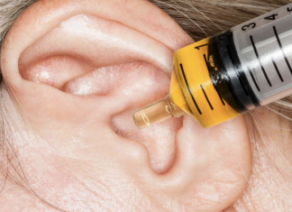 5 Ways How to Treat Itchy Ears