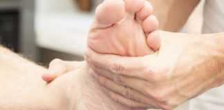 Treat bunions using these 8 home remedies