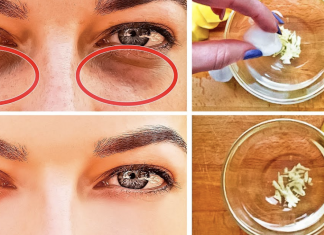How to Get Rid of Black Circles Under Your Eyes