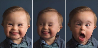 BABY BOY WITH DOWN SYNDROME BECOMES MODEL FOR OSHKOSH B’GOSH