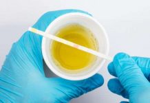 You can a lot about your health just from the color of your urine