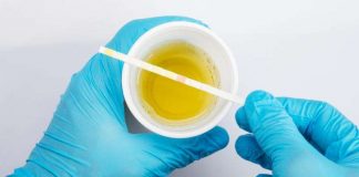 You can a lot about your health just from the color of your urine