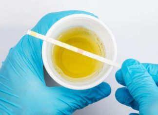 You can a lot about your health just from the color of your urine