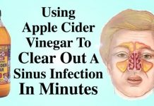 How To Kill Sinus Infection In Few Minutes Using Apple Cider Vinegar!