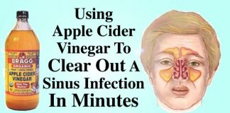 How To Kill Sinus Infection In Few Minutes Using Apple Cider Vinegar!