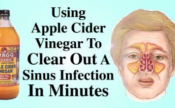 How To Kill Sinus Infection In Few Minutes Using Apple Cider Vinegar!