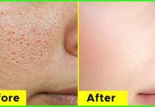 How To Minimize The Appearance Of Large Pores
