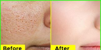 How To Minimize The Appearance Of Large Pores