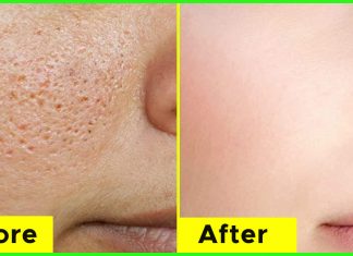 How To Minimize The Appearance Of Large Pores
