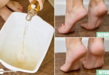 11 Ways To Use Listerine That Have Nothing To Do With Freshening Your Breath