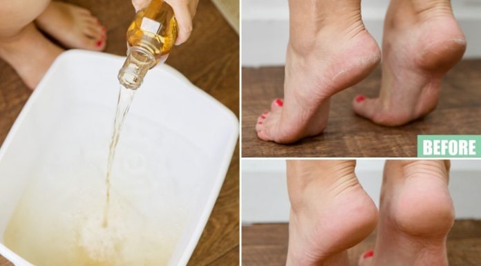 11 Ways To Use Listerine That Have Nothing To Do With Freshening Your Breath