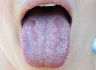 8 Symptoms Of B12 Vitamin Deficiency