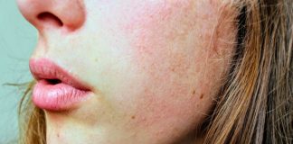 10 Common Daily Things That Can Cause Your Skin To Age