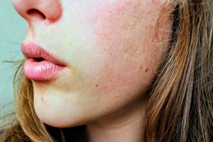 10 Common Daily Things That Can Cause Your Skin To Age - Beauty 2024 | PopcornTime