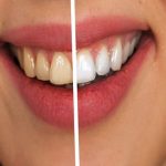 Avoid These Things That Cause Your Teeth To Turn Yellow!