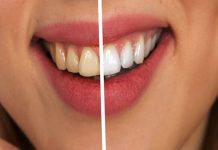Avoid These Things That Cause Your Teeth To Turn Yellow!