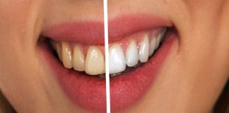 Avoid These Things That Cause Your Teeth To Turn Yellow!