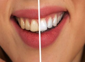 Avoid These Things That Cause Your Teeth To Turn Yellow!